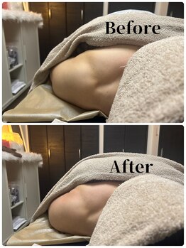 フィール(feel)/整体+リンパ Before & After