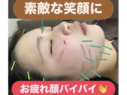 けん鍼きゅう整骨院の写真