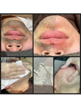 ステラマリス(STELLA MARIS)/男爵お髭エチケット匠道WAX脱毛