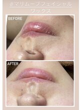 美顔秘密基地 新宮/フェイシャルワックス