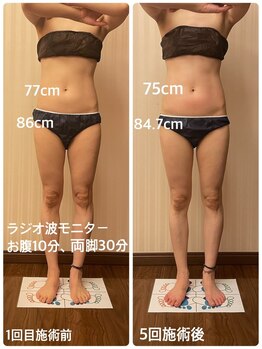 ライトウェーブ 諏訪インター店/ハイパーナイフ 5回 変化