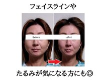 みなと/姿勢を良くして小顔効果アップ♪