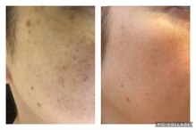 ソワンドゥース ヴェール(Soin douse Vert)