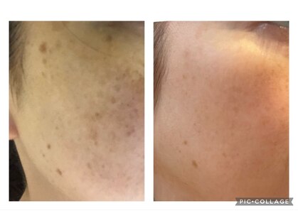 ソワンドゥース ヴェール(Soin douse Vert)の写真