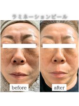 シェリール(cherir)/ラミネーションピール