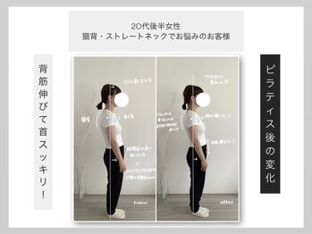 ウィット(Wit.)/昔からの猫背、巻き肩でお悩み