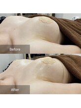 ルミエール(Lumiere)/【倉敷市】バストアップ施術事例