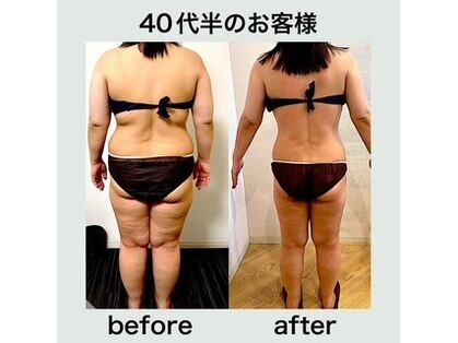 エステサロンクオーツの写真