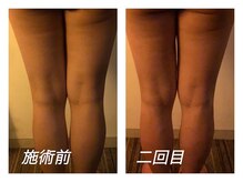 美 ラインの雰囲気（年齢を重ねると落ちにくくなるお肉に徹底的にアプローチ！）