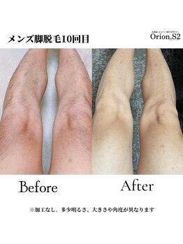 オリオンドットエスツー(Orion.S2)/【Before→After】