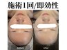 新規様必見！【毛穴ケア・肌質改善】幹細胞ハーブピーリング　¥15400→¥11000