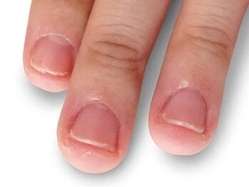 ビエル(BIeL)/京都自爪育成 フィルイン