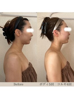 リーブル(LIBRE)/ブライダル コルギ&ボディ