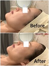 スペチアーレ 夙川/横顔を更に美しく