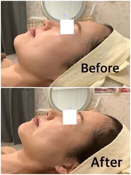 スペチアーレ 夙川/横顔を更に美しく