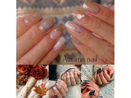 ロアナ(Roana)の写真