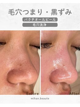 ミハン ボーテ(mihan.beaute)/