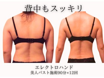 エイミー(Aimee)/背中もスッキリなめらかに