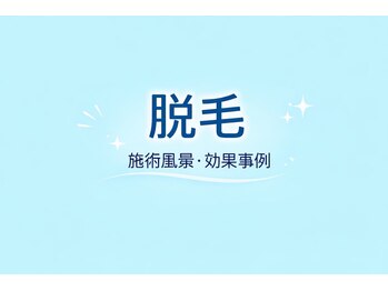 ラブ アンド ピース(Love&Peace)/脱毛/各務原/鵜沼/メンズ/