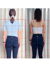 エヌーピラティス(ENEU PILATES)/背中痩せ　before→after