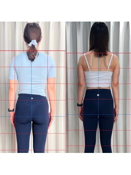 エヌーピラティス(ENEU PILATES)/背中痩せ before→after