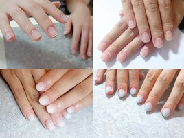 深爪矯正 美爪スカルプ 長さ出し