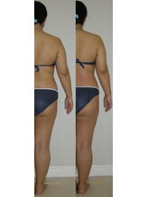 アルマ 芦屋(ALMA)/右の変化が大きいということは？