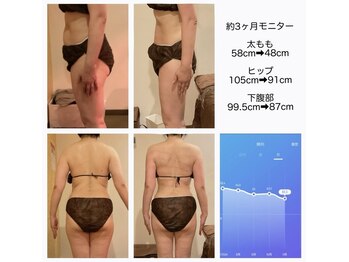 サロン リーナ 北千住店(Salon Lena)/根本改善痩身コース