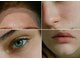 クリニカルボーテ 心斎橋院(CLINICAL BEAUTE)の写真/医療機関提携×看護師施術で、360度どこから見られても美しい小顔と美肌を叶える★一生に一度の特別な日に