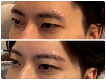 スリーピース(3Peace)/Before/After