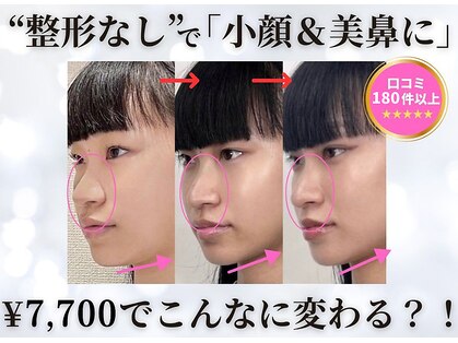 隆鼻矯正専門店 ラプリエイル 千葉店(Raplit aile)の写真