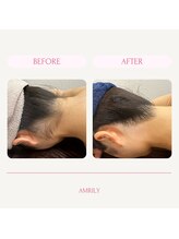 アムリリー 南草津店(AMRILY)/うなじ脱毛