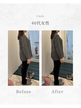 アンドゥ(Undo)/骨盤の傾きを整え美姿勢に♪