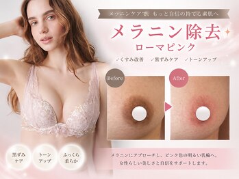 ハク 阪急茨木(HAKU)の写真/ローマピンク