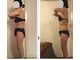 シェルシア(Cielcia)の写真/【圧倒的変化！軽さと見た目】筋膜×リンパで首肩改善×痩身を同時に叶えるオールハンド施術９０分￥8.500