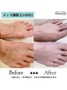 オリオンドットエスツー(Orion.S2)/【Before→After】