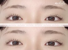 エクララ(eclala)/まつげパーマ