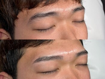 メノール(MENOR)/間引きでコントラストを調整