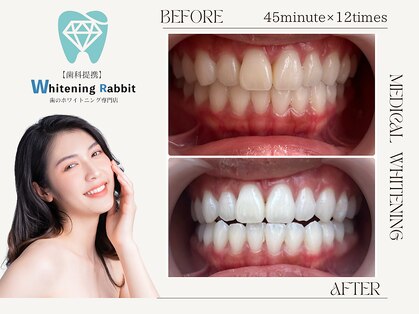ホワイトニングラビット(Whitening Rabbit)の写真