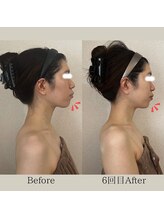 リーブル(LIBRE)/小顔コルギ　６回