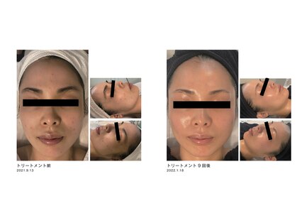セラピア(Serapia)の写真