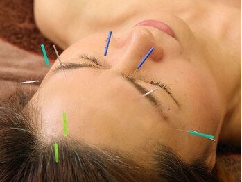 きえ鍼灸整骨院/はり