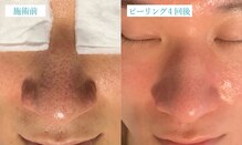 マリーボーテ 名古屋店