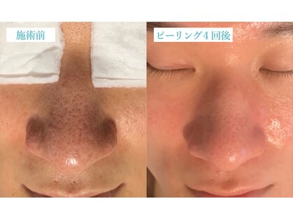 マリーボーテ 名古屋店の写真