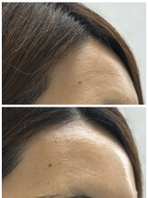 ファームディ(Pharm.D)/シワの悩みに