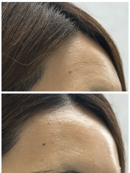 ファームディ(Pharm.D)/シワの悩みに