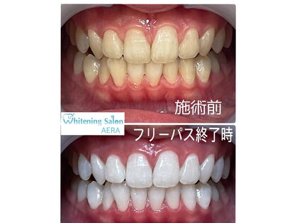 アエラ(AERA)の写真