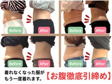 ホープ鍼灸整骨院