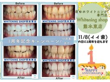 ホワイトニングショップ熊本東店