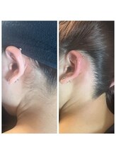 アットユウ(@yu)/シュガーリング《うなじ》